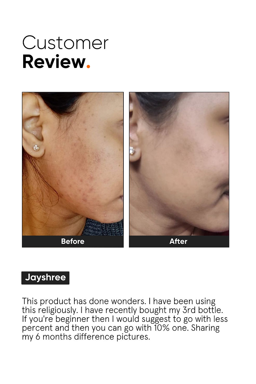 Niacinamide 10% Face Serum